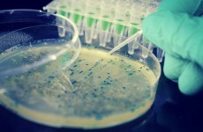 Queen's University team develops breakthrough anti-superbug gel
