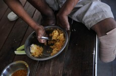 In focus: Myanmar struggles with ancient scourge of leprosy