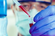 Column: What exactly is an 'outbreak'?