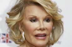 US comic Joan Rivers has died