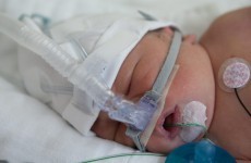 Irish firm hopes to save premature babies with new research
