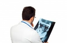 Irish scientists have figured out a way to diagnose bowel cancer earlier