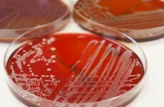 Scientists unveil magnetic gadget that can strip toxins out of blood