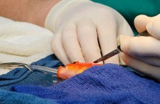 Goldfish recovering after undergoing high risk brain surgery