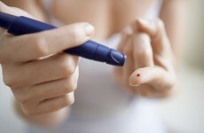 Tests on "artificial pancreas" described as the "next revolution" in diabetes care