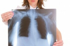 'You could have lung disease, but won't notice if your only exercise is shopping'