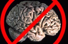 Column: Dear student, the Leaving Cert is damaging your brain
