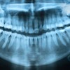 'DNA is sexy' but dental records most useful for identifying bodies