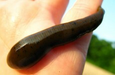 Woman finds three-inch leech living up her nose