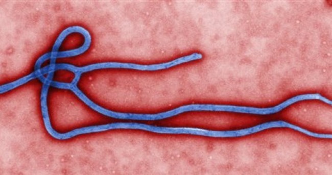 Ebola: Is it contagious and how does it spread? Here are the facts