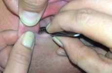 Friends pull huge moth out of man's ear with tweezers