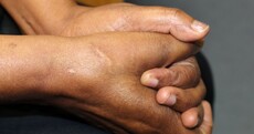 The scars that brought us to Ireland: Asylum seekers on the violence that made them flee