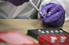 Scientists discover virus that makes people 'more stupid'