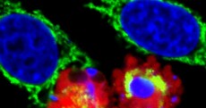 Breakthrough by Irish scientists could lead to cure for Parkinson's Disease