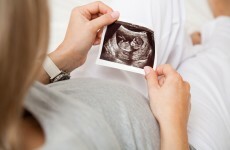 Ireland is NOT one of the safest places on the planet to have a baby