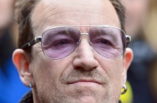 Bono had 'three metal plates and 18 screws' inserted into his elbow following his accident