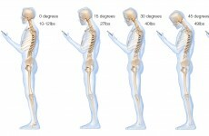 This is what looking down at your phone does to your spine