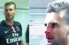 Footballer Brandao jailed for Motta headbutt