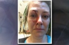 Facebook pic helps police capture man who punched woman in the face