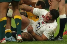 Watching Brad Barritt's hit on Quade Cooper still gives us a killer headache