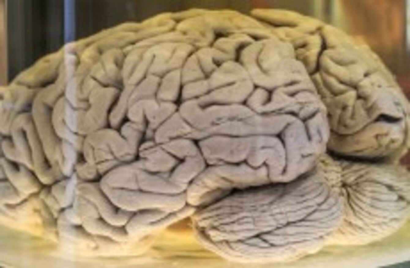 100 Human Brains Have Gone Missing From A University In Texas