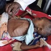 UN declares famine in parts of Somalia