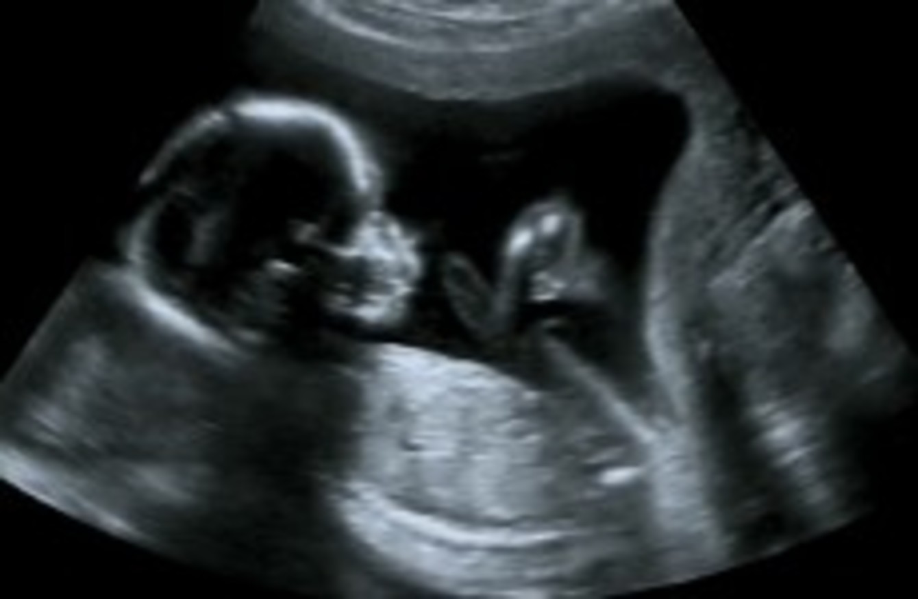 Private ultrasound scans - tonyshirley.co.uk