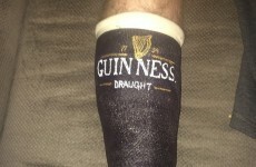 Here's an absolutely genius way to spruce up a boring old cast