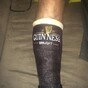 Here's an absolutely genius way to spruce up a boring old cast