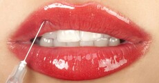 Unregulated plastic surgery procedures offered to 15 year olds