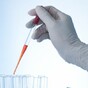 Stem cells from human eggs can now be patented