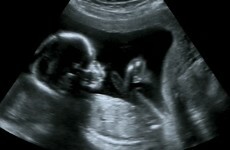 'How was this woman told her baby was dead, but there's a heartbeat?': The week in quotes