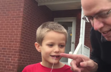 Dad of the Year pulls his son's tooth with a golf club and dental floss