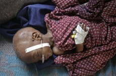 UN launches urgent appeal for donor help in East Africa
