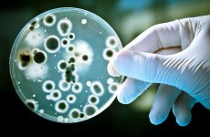 A new antibiotic could finally turn the tide against superbugs and drug-resistant infections