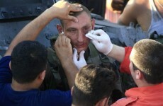 Bomb wounds five UN peacekeepers in Lebanon