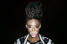 Model with rare skin condition unveiled as face of two major fashion campaigns