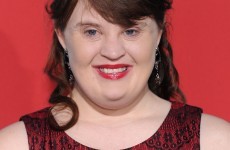 Jamie Brewer is the first model with Down Syndrome to walk in NY Fashion Week