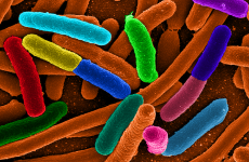 12 children affected by E-coli in Lurgan nursery