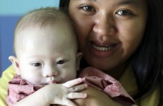 Thailand bans surrogacy for foreigners after Baby Gammy scandal