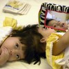 Formerly conjoined twins celebrate milestone 10th birthday