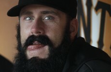 Baseball crazyman Brian Wilson says he eats 60 eggs a week