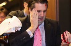 American ambassador has face slashed by knife-wielding protester
