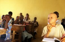 Albino people 'killed for their body parts' in spate of Malawi murders