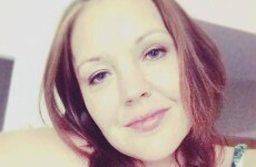 I had to live for two years without a forehead - all because of one tiny mistake
