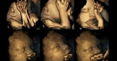 These scans show the harmful effects of smoking on unborn babies