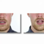 Trippy Vine changes depending on what side you look at