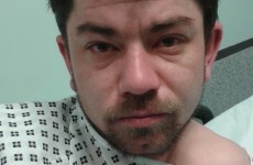 Police ask for help identifying Polish man who can't remember who he is