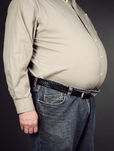 Obese people less likely to develop dementia