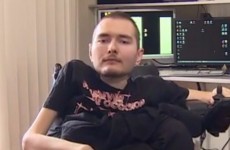 This man has volunteered to have the first-ever head transplant